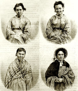 puerperal